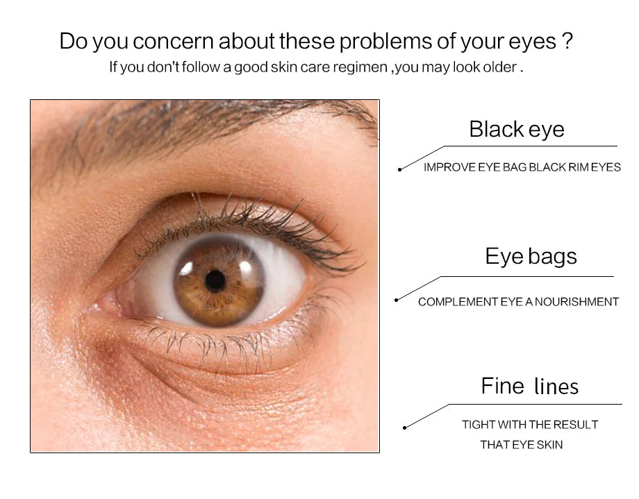 Gold Eye Patches