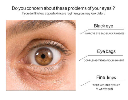 Gold Eye Patches